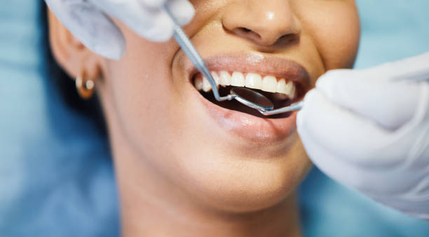 Best Emergency Dental Care for Broken or Chipped Teeth in Winnsboro, SC